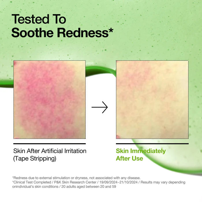 Azelaic Acid Hyaluron serum